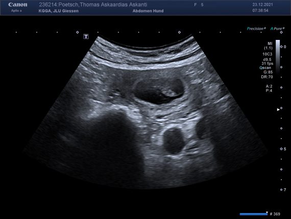 00087541_00236214_DICOM_US_2021_12_23_0017003340