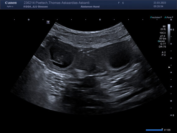 00087541_00236214_DICOM_US_2023_03_23_0019611821